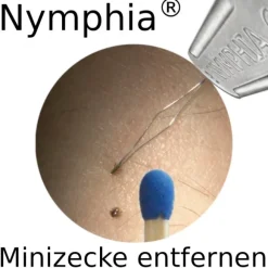 Nymphia Zeckenentferner